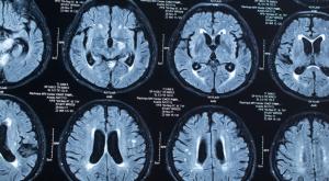 "Энцефалография покажет" - после визита омбудсмена у Дадина поищут эпилепсию